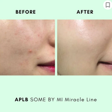 Load image into Gallery viewer, SOME BY MI - AHA, BHA, PHA 30 Days Miracle Serum 50ml
